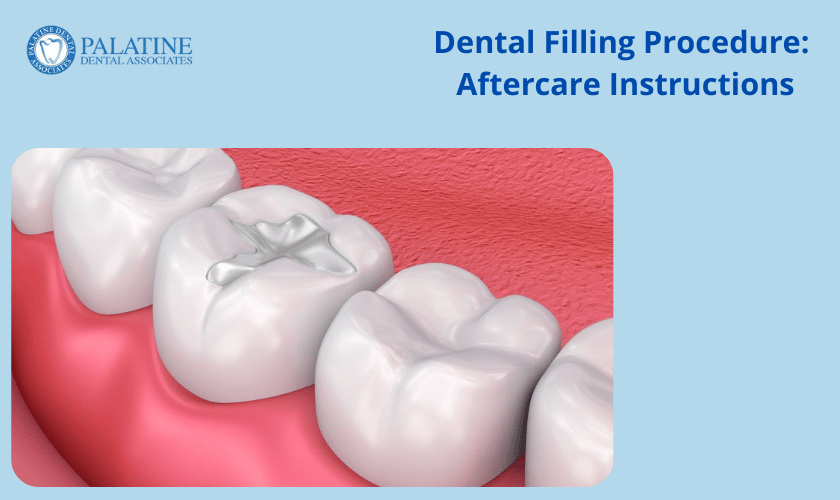 Dental Filling in Palatine
