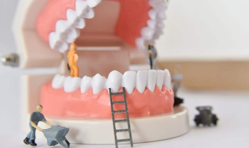 Tooth Decay And Cavities