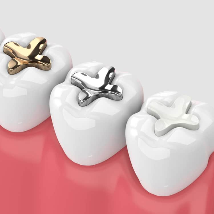 Three tooth-shaped models displaying different dental crown materials and finishes against pink background.