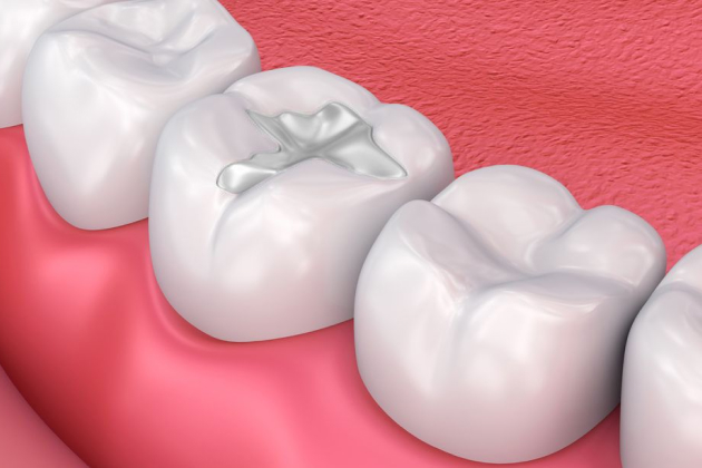 3D dental illustration showing teeth and gums with focus on tooth structure and oral health.